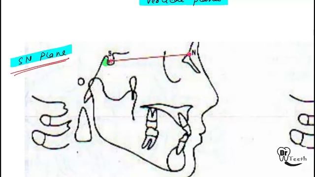 Cephalometrics Part 1 смотреть онлайн