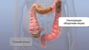 Толстая и прямая кишка  Очищение кишки человека