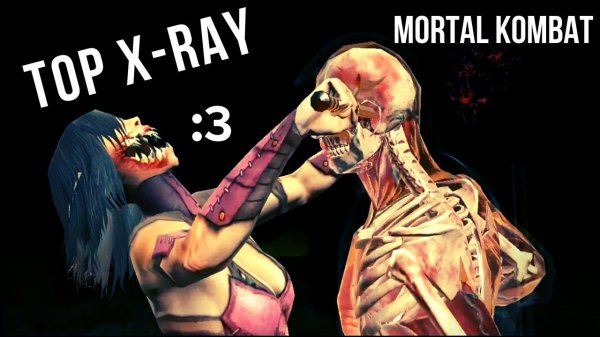 Top X-RAY | MORTAL KOMBAT (mobile)