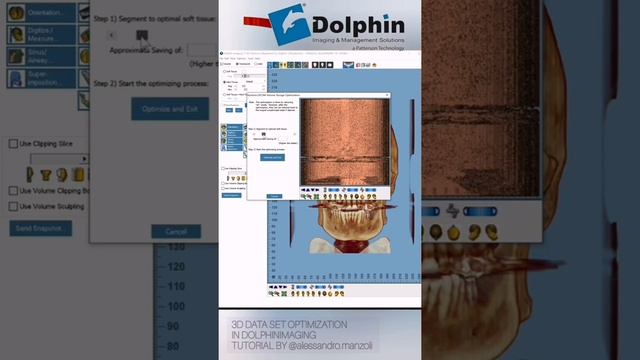 Dolphin Imaging 3D DATASETS OPTIMIZATION ....Reduce out of memory errors смотреть онлайн