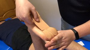 Наложение кинезио тейпа на квадратную мышцу подошвы