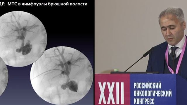 Рубен Аанесян