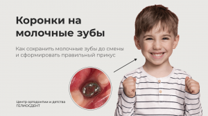 Коронки на молочные зубы
