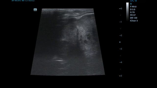 опухоль надпочечников, МТС у кота смотреть онлайн