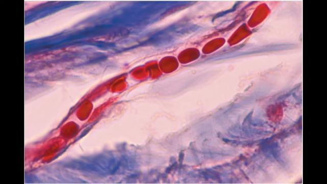 Анатомия и физиология - Лекция 31 - Артерии, капилляры, капиллярная гемодинамика