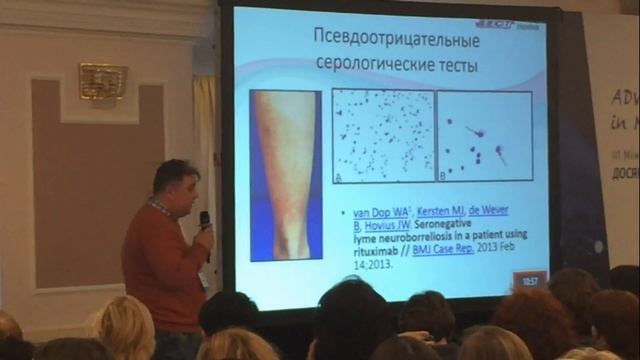 Мальцев Д В Диагностика нейроборрелиоза смотреть онлайн