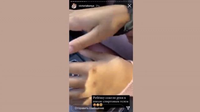 Виктория Боня в ужасе от вида рук дочери после антисептика смотреть онлайн
