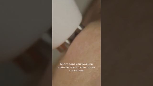 Омоложение без боли и восстановления смотреть онлайн