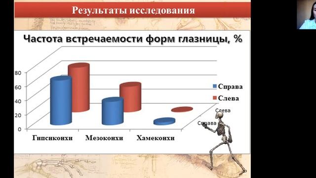 БИЛАТЕРАЛЬНАЯ ИЗМЕНЧИВОСТЬ ЛИНЕЙНЫХ ПАРАМЕТРОВ КЛЫКОВОЙ ЯМКИ ПРИ РАЗЛИЧНЫХ ФОРМАХ ГЛАЗНИЦЫ У ЖЕНЩИН смотреть онлайн