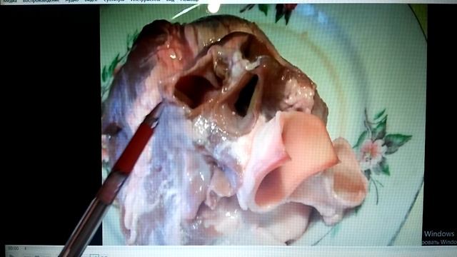 СЕРДЦЕ на ладони! смотреть онлайн