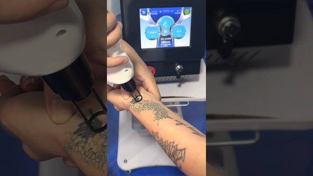 high-quality 3-wavelength diode laser hair removal machine 广州林光脱毛仪器工厂，广州最专业的脱毛仪器工厂，康少林：19128871198 смотреть онлайн