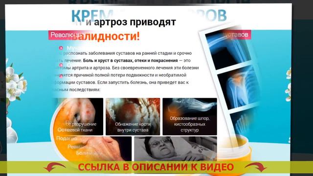 АРТРИТ ПАЛЬЦЕВ РУК ЛЕЧЕНИЕ ПРЕПАРАТЫ ⛔ ГЕЛИ ОТ БОЛИ В ПОЯСНИЦЕ СПИСОК ЛУЧШИХ смотреть онлайн
