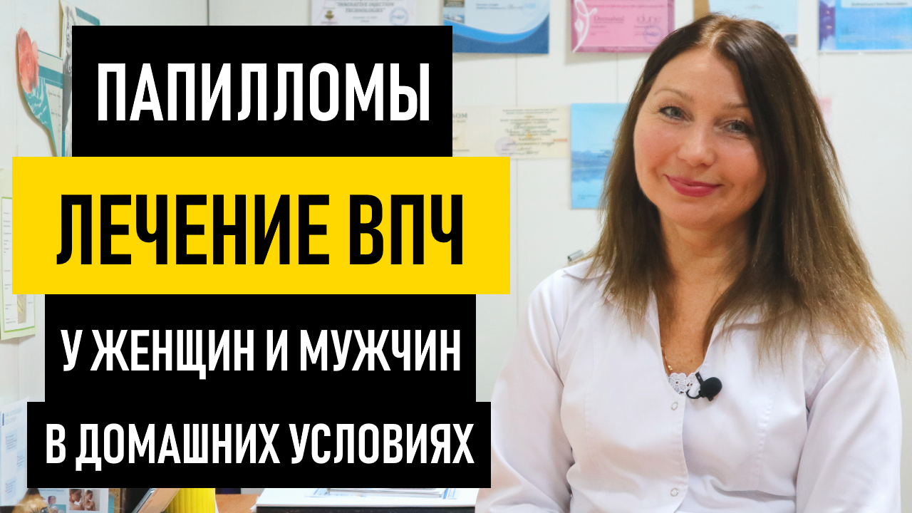 Лечение ВПЧ у женщин и мужчин. Чем и как лечить вирус папилломы человека в домашних условиях смотреть онлайн