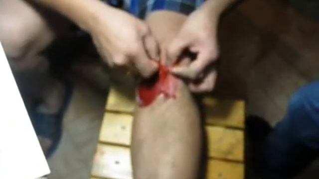 Клип И Павлов самоучитель по хирургии Фрагмент100 00 02 00 21 33 смотреть онлайн