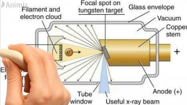 HOW X RAYS ARE FORMED ? | X RAY BASICS | X RAY IN TAMIL | X RAY TUBE  #TAMILDENTICO #XRAY