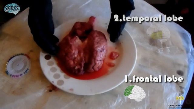 The Brain Disection by SERES Part 1 смотреть онлайн