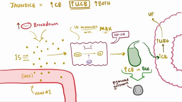 Jaundice - causes, treatment & pathology.mp4 смотреть онлайн