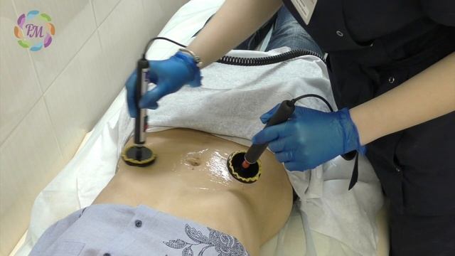 Миостимуляция Изоджей | Роял Медик смотреть онлайн