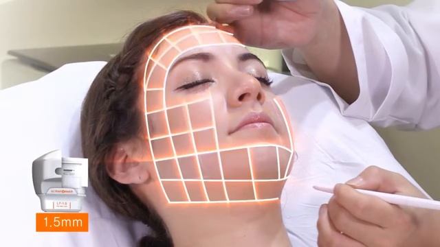 Ultraformer смотреть онлайн