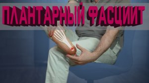Плантарный фасциит. Что это такое? Как вылечить?