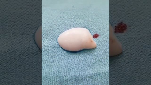 Удаляем пятна крови перекисью водорода смотреть онлайн