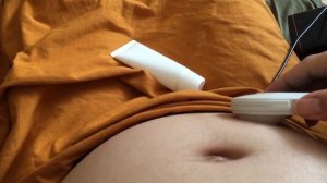 Фетальный ДОПЛЕР | Услышали сердечко уже в 10 недель | наш спаситель