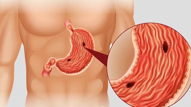 Имбирь полезные свойства и противопоказания. Чем полезен имбирь для мужчин и для женщин