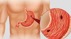 Имбирь полезные свойства и противопоказания. Чем полезен имбирь для мужчин и для женщин
