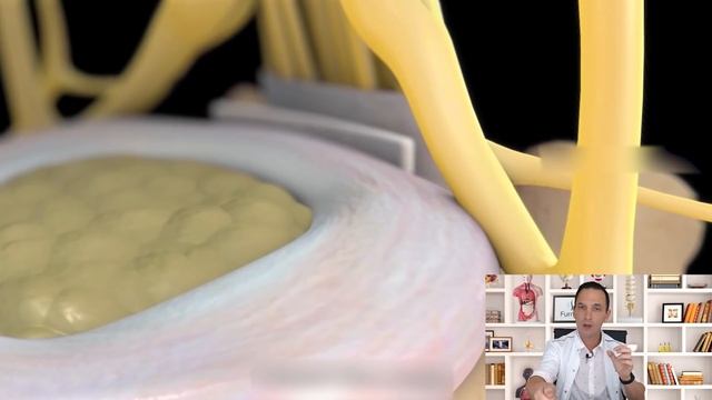 ? Como QUITAR El Tinnitus De Forma NATURAL ? [Acufenos - Zumbido De Oídos]