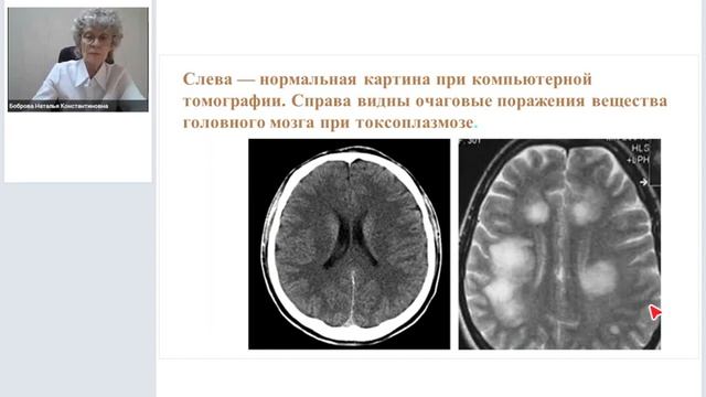 Вич-инфекции. Часть2.mp4