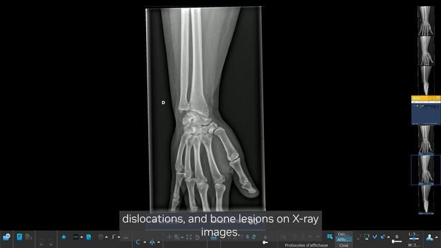 NVIDIA Inception | Gleamer Uses AI to Help Radiologists смотреть онлайн