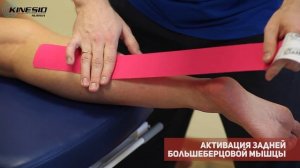 Кинезиотейпирование. Активация задней большеберцовой мышцы