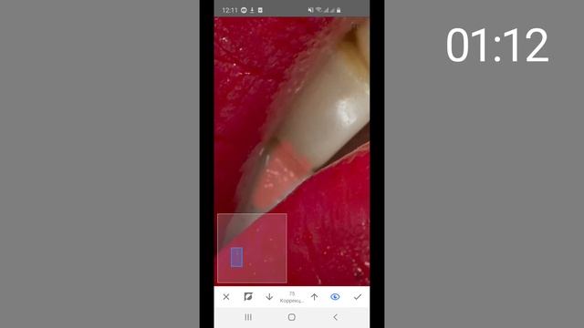 Отбеливание зубов с помощью Snapseed. Портфолио мастера перманентного макияжа смотреть онлайн