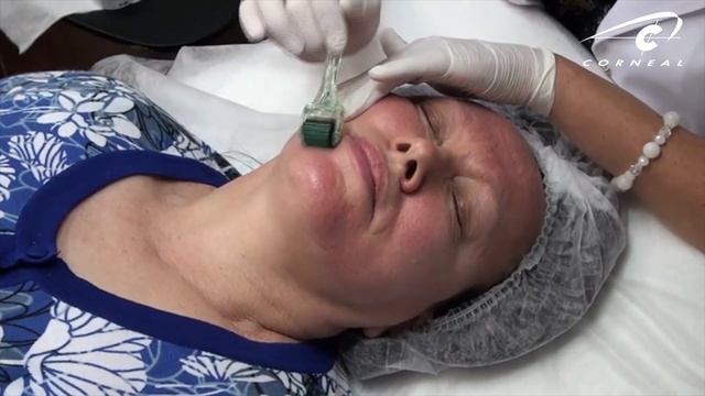 Когда стоит увеличивать размер роллера смотреть онлайн