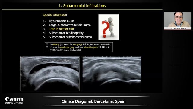 CANON ULTRASOUND WEBINAR | Ultrasound & Guided interventions: High-resolution ultrasound of shoulde смотреть онлайн