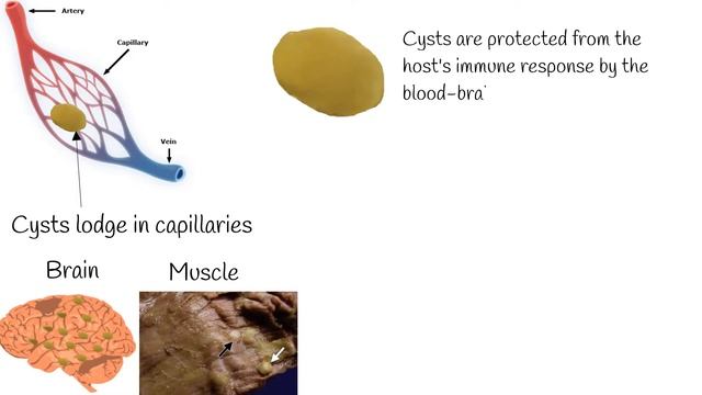 Neurocisticcircosis symptoms and treatment. Why is pork tapeworm so dangerous? смотреть онлайн