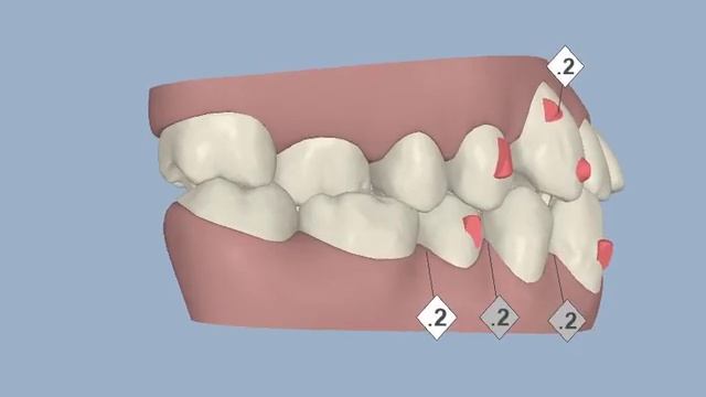 My Teeth смотреть онлайн