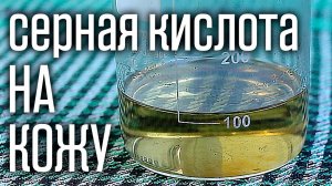 Что будет если серная кислота попадет на кожу? Первая помощь при ожогах.