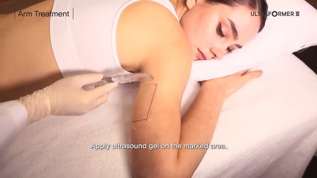 Коррекция фигуры на аппарате ULTRAFORMER III Body treatments смотреть онлайн