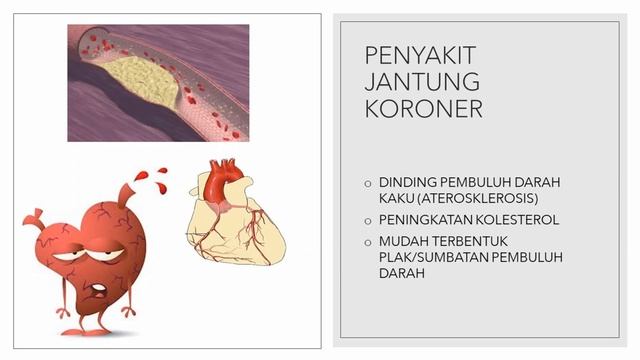 Patepang di Awang awang #11 (Osteoporosis) | Sesi.2 смотреть онлайн