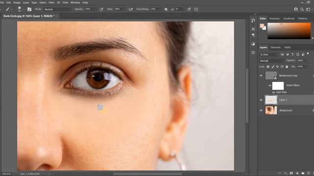 Dark Circles Kaise Hataye | Remove Dark Circle | Remove dark circles under eyes naturally смотреть онлайн