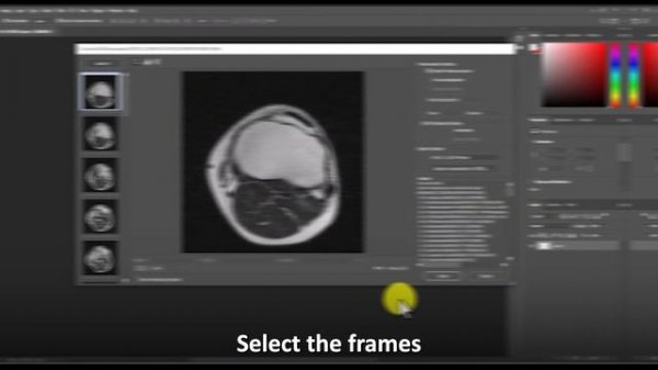 How to View a DCM File (How to Open DCM Files)
