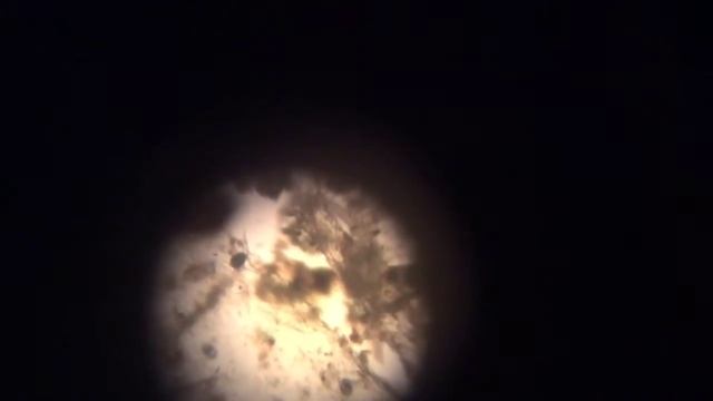 Микробы под микроскопом! Биологический музей имени Тимирязева! смотреть онлайн