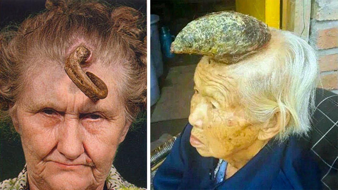 Реальные Люди, у Которых Растут Рога смотреть онлайн