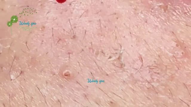 Make Your Day Relaxing with Windy Spa 6#113 смотреть онлайн