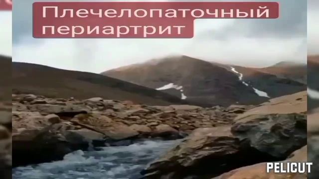 ?️Плечелопаточный периартрит, болезнь Дюпеля. Матрица Гаряева. смотреть онлайн