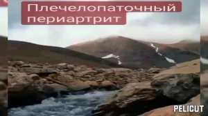 ?️Плечелопаточный периартрит, болезнь Дюпеля. Матрица Гаряева.