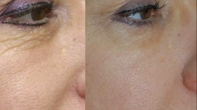 эффективные маски для омоложения лица смотреть онлайн