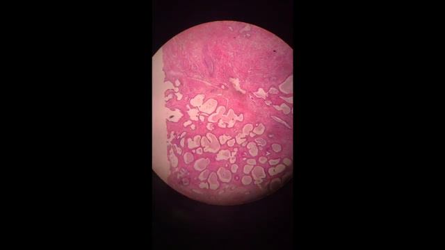 PATHOLOGY 2 || Microscope slides || Final exam || 1 смотреть онлайн