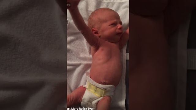 Рефлекс Моро у новорожденного смотреть онлайн